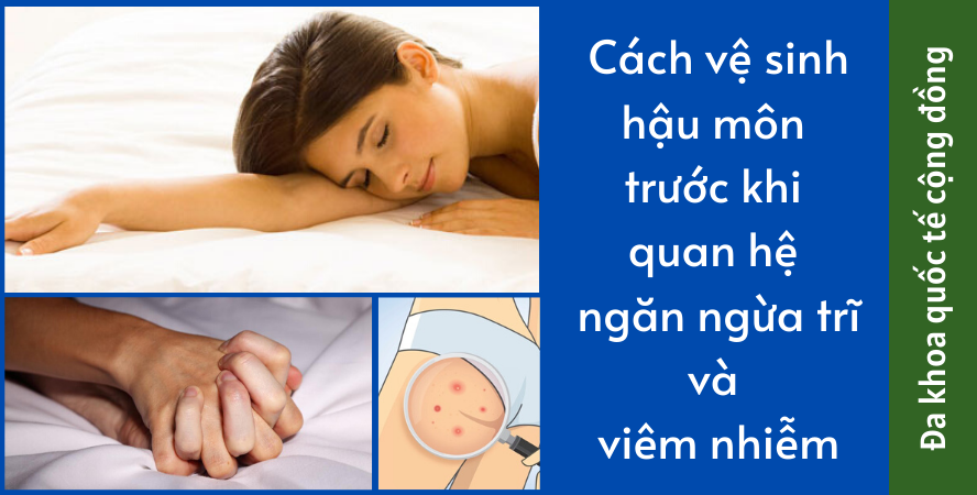 Cách Vệ Sinh Hậu Môn Trước Khi Quan Hệ Ngăn Ngừa Trĩ Và Viêm Nhiễm