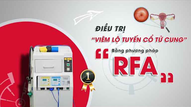 Công nghệ RFA điều trị viêm lộ tuyến cổ tử cung