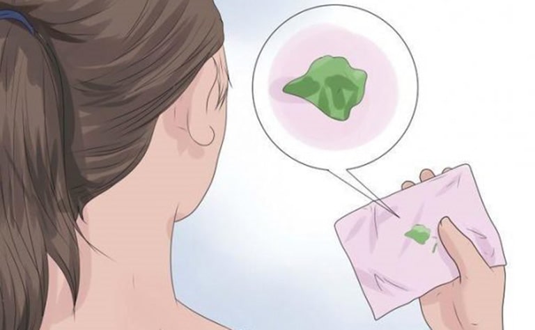 Cách chữa khí hư màu xanh tại nhà chị em nên biết