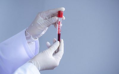 Bệnh giang mai xét nghiệm máu có phát hiện ra không? [Chuyên gia giải đáp]